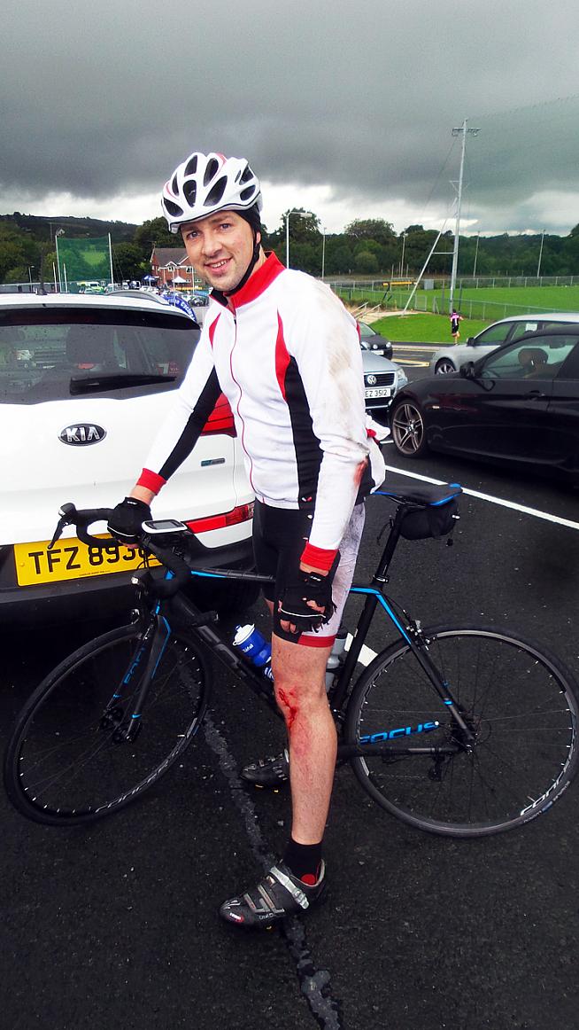 Slippy roads claimed one victim - although Aaron was more bothered about his ripped shorts than his knee!